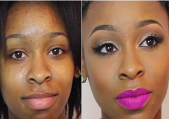 Antes e depois: o poder da maquiagem para cobrir acne e marcas
