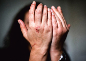 Lei federal obriga autor de violência doméstica a ressarcir governo por atendimento à vítima