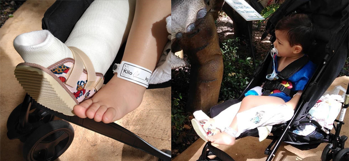 EUA: Conrado passa por cirurgia na mão e retira fixador da perna