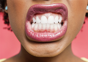 Bruxismo: o que causa o mal e como tratar o ranger de dentes