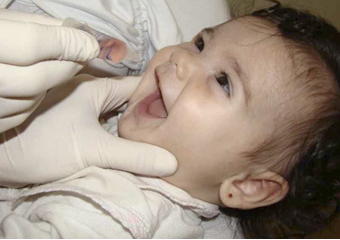 Vacinação nacional contra a paralisia infantil será em setembro